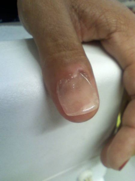 UNHAS DE GEL E PORCELANA (recuperação cada unha)